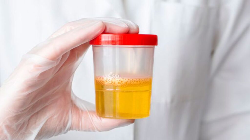 Urina Espumosa no Pote